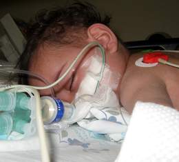 Cảnh giác viêm phổi mùa lạnh ở trẻ em, các mẹ chớ nên lơ là